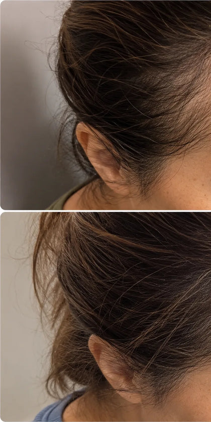 Jennifer S., month 1