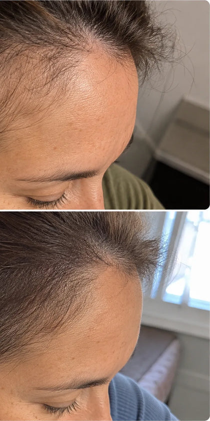 Jennifer S., month 5