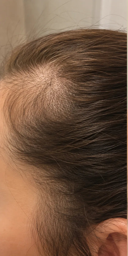 Christine G., month 1