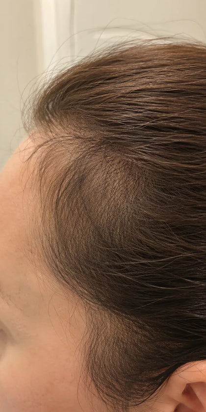 Christine G., month 3