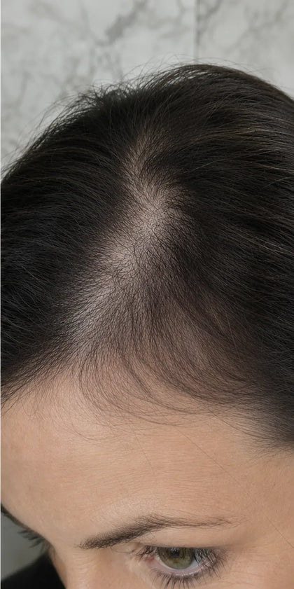Paula T., month 3