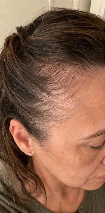 Katherine B., month 1