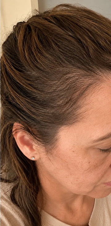 Katherine B., month 3