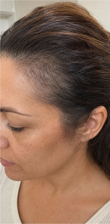 Brenda B., month 4