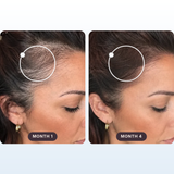 Slide 3, before and after pair